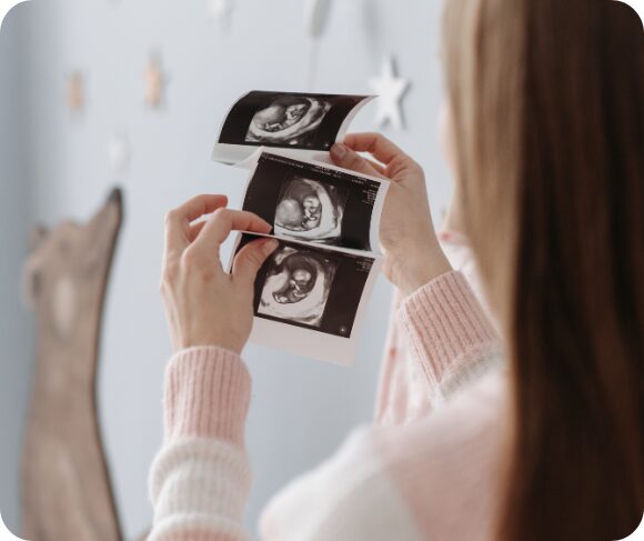 When to Get an Anomaly Scan? – Best Weeks for Screening