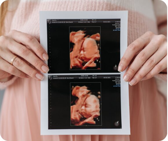 Anomaly Scan for Gender Determination – Accuracy & Timing