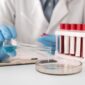 Lab Tests – Importance, Types & When to Get Tested