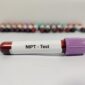 A test tube with blood, representing the sample collection for NIPT (Non-Invasive Prenatal Testing) to assess pregnancy health.