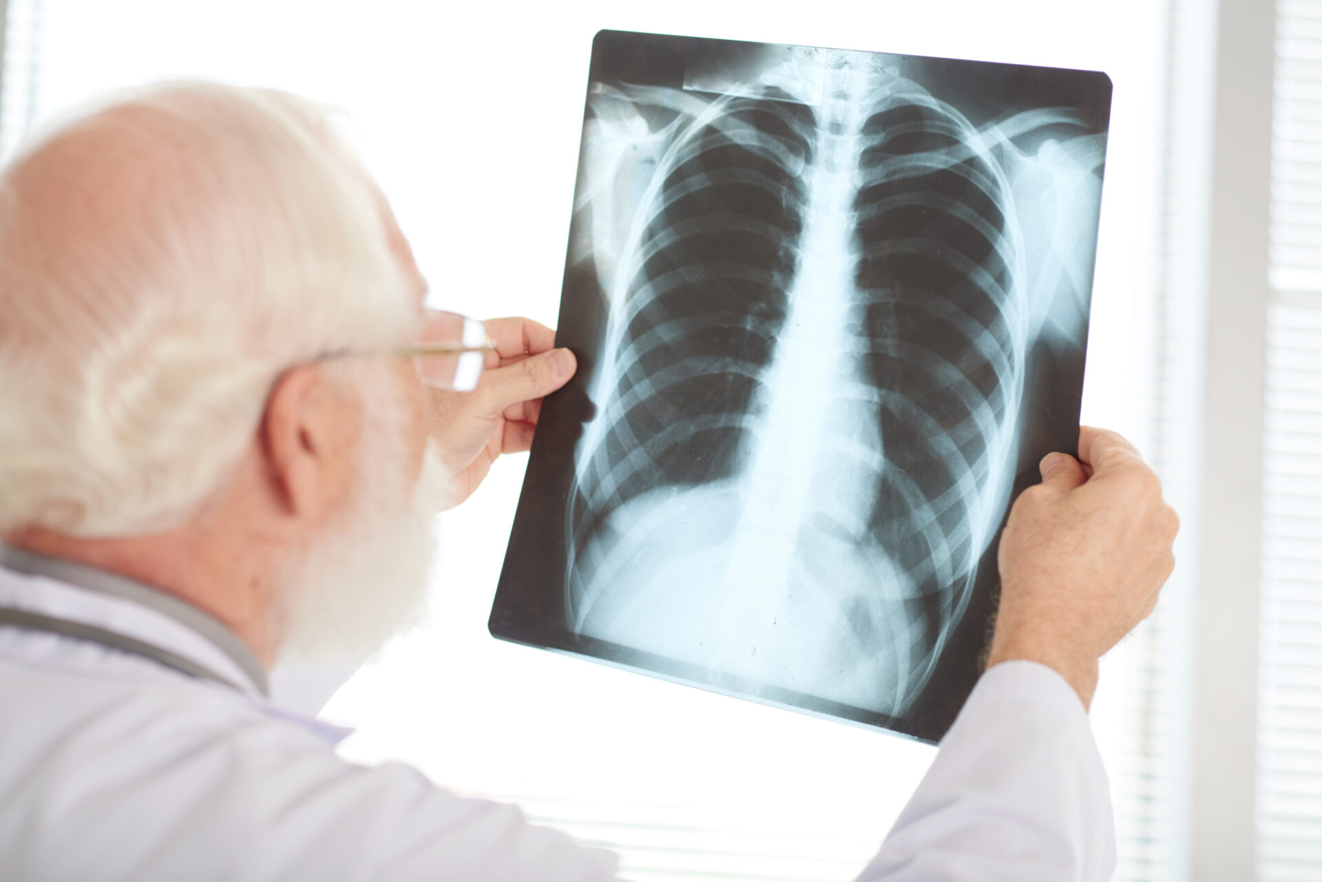 chest xray