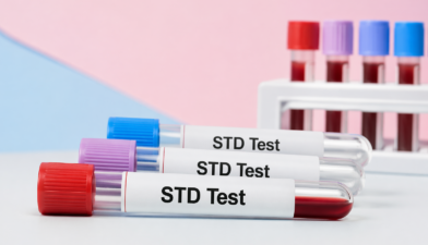 STD Test at Home Dubai Cost