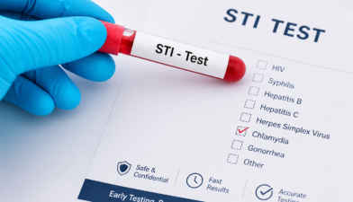 STI Lab Test