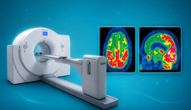 FDG PET Scan